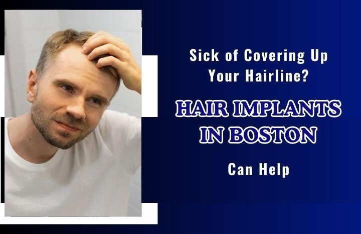 Sick-of-Covering-Up-Your-Hairline-Hair-Implants-in-Boston-Can-Help