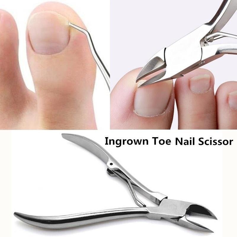 Best Ingrown Nail Scissors