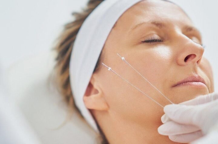 Nose Thread Lift in Dubai